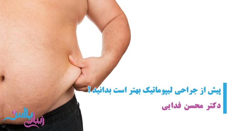 ابرو,اندام,بازو,براکیوپلاستی,بوتاکس,بوکال,پروتز,پروتز چانه,پروتز سینه,پروتز گونه,پلاس,پلک,پوست,پوست و مو,پهلو,تخصصی,تزریق,تزریق باسن,تزریق چربی,تزریق چربی باسن,تغذیه,جراحی,جراحی بازو,جراحی باسن,جراحی دایم لب,جراحی دائم لب,جراحی ران,جراحی زیبایی,جراحی زیبائی,جراحی سینه,جراحی شکم پهلو,جراحی معده,جوانجوان سازی,جوانسازی,چانه,چربی,خدمات,خدمات زیبایی,خدمات زیبائی,دایم,دائم,دندان,دهان,دهان و دندان,ران,رسانه,رسانه تخصصی جراحی و خدمات زیبایی,رینوپلاستی,زاید,زائد,زیبایی,زیبایی اندام,زیبایی پلاس,زیبایی صورت,زیبائی,ژل,سانترال,سینه,شقیقه,شکم,شکم پهلو,صورت,غیر تهاجمی,غیرتهاجمی,فک,فک و صورت,فیلر,کاهشی,گونه,لاغری,لاغری غیر تهاجمی,لاغری غیرتهاجمی,لب,لیپو,لیپو بازو,لیپو ران,لیپو شکم پهلو,لیزر,لیزر موهای زاید,لیزر موهای زائد,لیزر و جوان سازی,لیزر و جوانسازی,لیفت,لیفت ابرو,لیفت بازو,لیفت باسن,لیفت پلک,لیفت ران,لیفت سانترال,لیفت سانترال لب,لیفت سینه,لیفت شقیقه,لیفت صورت,ماموپلاستی,ماموپلاستی کاهشی,معده,مو,موهای,جراحی پلاستیک,پلاستیک,دکتر,پزشک,پزشکان,ترمیم,ترمیمی,عمل,دست,پا,پستان,زیبا,ziba,zibaei,zibaee,zibaye,zibaie,zeebaa,zebaei,zebayei,zibaeiplus,zibaei plus,plus,زیبائی پلاس