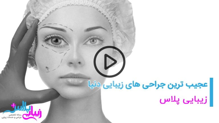 bad comestic surgery video.jpg
