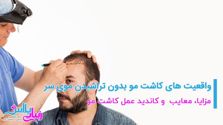 hair transplant.jpg