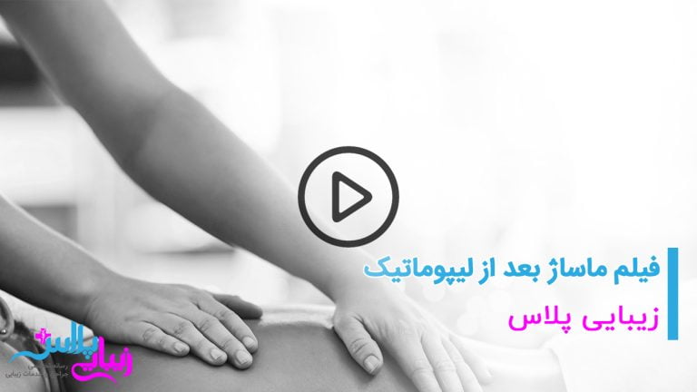 massage lipomatic 1.jpg