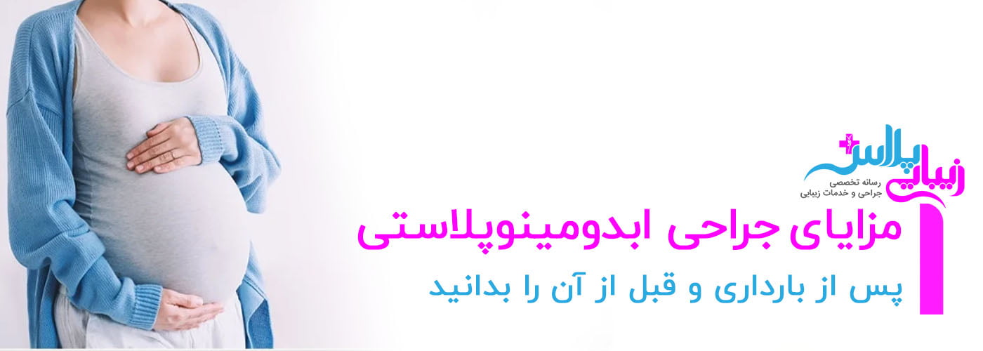 pregnant abdominoplasty 1.jpg