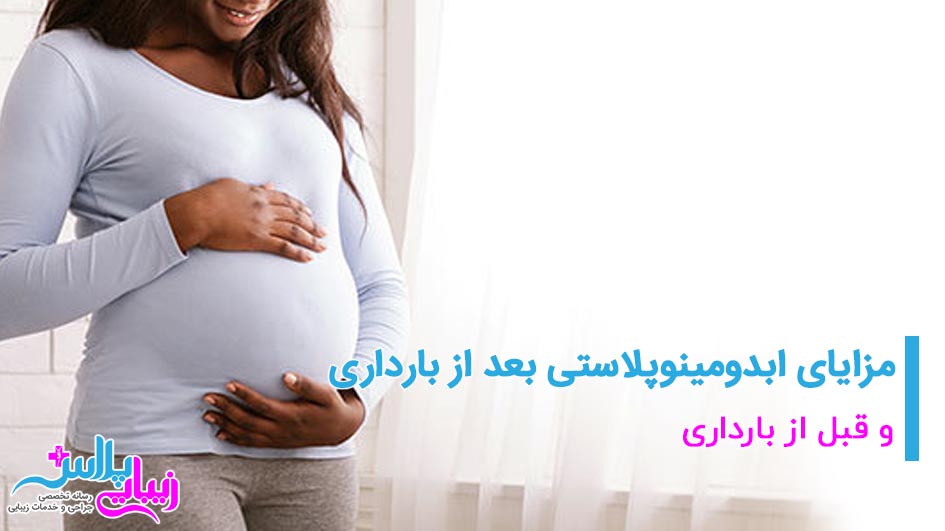 pregnant abdominoplasty.jpg