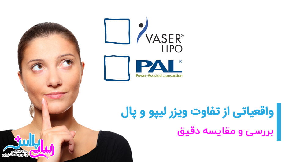 lipo vaser vs pal.jpg